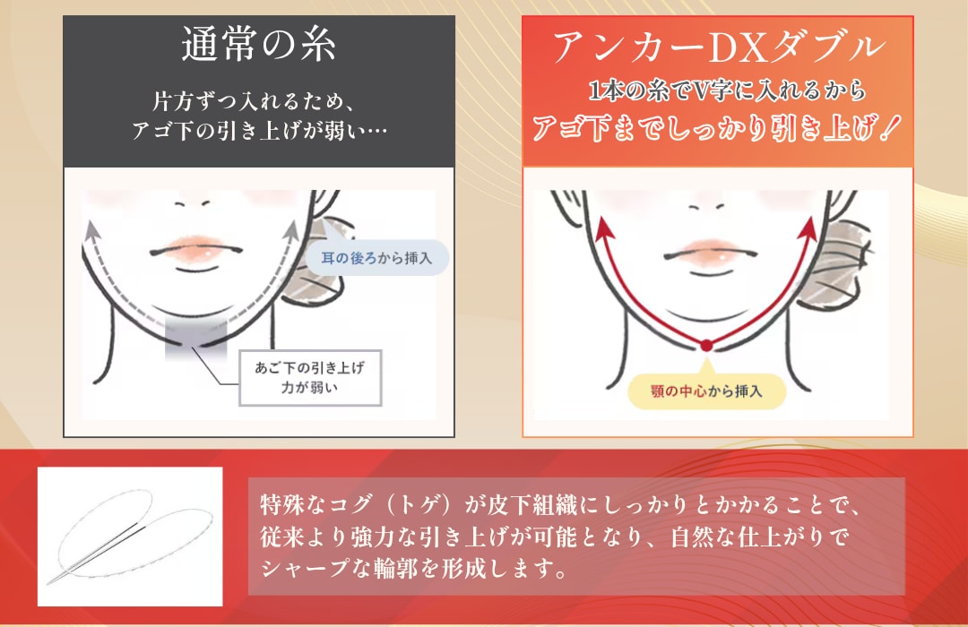 1本の糸ですっきり！二重顎解消のメカニズム